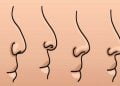Lihatlah Bentuk Hidung Anda dan Temukan Karakter Aslimu