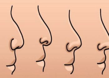 Lihatlah Bentuk Hidung Anda dan Temukan Karakter Aslimu