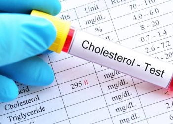 Awas, Berikut Ini Jenis Makanan Pemicu Kolesterol Tinggi