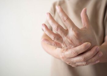 Autoimun SLE yang diderita Isyana