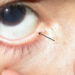 Fungsi lacrimal punctum yang sangat penting