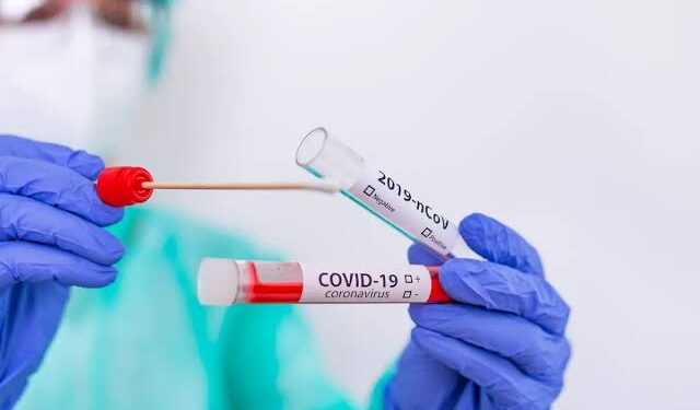 Pemerintah meminta masyarakat untuk waspada jenis varian Covid-19 bernama Arcturus yang menyebar di sejumlah daerah di Indonesia