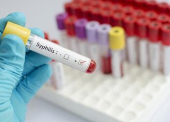 Penyakit Sifilis atau Raja Singa menghantui sejumlah daerah di Jawa Barat