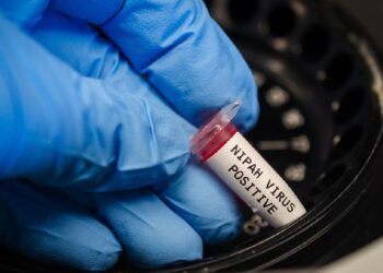 Ancaman Virus Nipah Lebih Berbahaya Ketimbang Covid