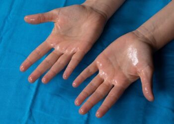 Mengungkap Kondisi Misterius Hiperhidrosis