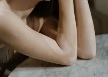 Inilah Perbedaan Bercak Putih dengan Panu