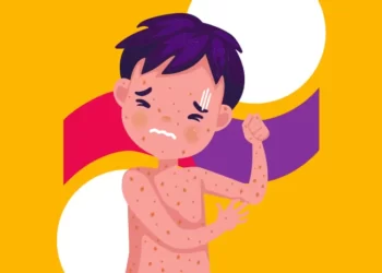 Simak, Cara Pasien Cacar Air Diperbolehkan Mandi